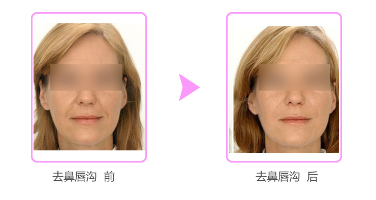 ȥ�Ǵ�������